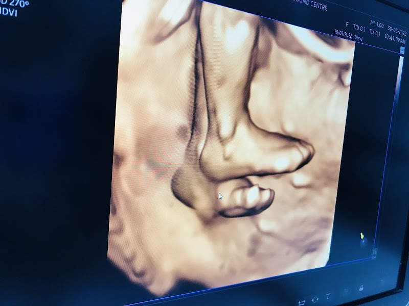 Dr. Seema's Ultrasound - Radiologist in Delhi