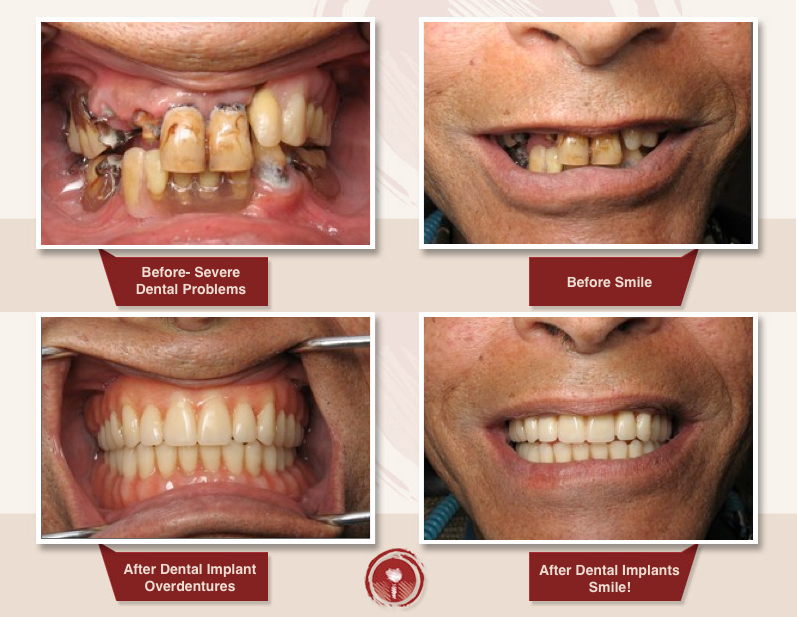 Sai Dental & - Dental Hospital in Delhi