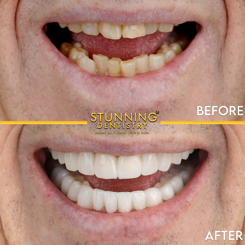 Stunning Dentistry - Dental Hospital in Delhi